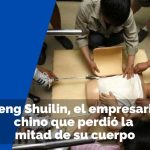 Peng Shuilin, el empresario chino que perdió la mitad de su cuerpo