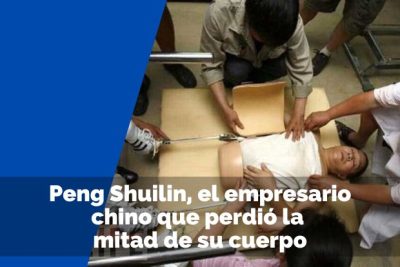 Peng Shuilin, el empresario chino que perdió la mitad de su cuerpo